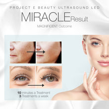 Load image into Gallery viewer, Facial & Eye Photon Ultrasonic Device | 3 Colors LED Red Blue Green Ultrasound Micro Vibration Facial Rejuvenation Skin Tightening Wrinkle Acne Spot Freckles Removal Toning Skin Care Beauty Home Use