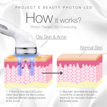 Load image into Gallery viewer, Blue LED+ Acne Light Therapy | 415nm Blue Photon LED Therapy Acne Spot Scars Removal Reduce Inflammation Reduce Inflammation Improving Sensitive Skin Calming Anti Bacteria Treatment Facial Device