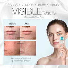 Load image into Gallery viewer, Derma Roller | 540 Titanium Micro Needle Facial Roller Microneedle Beauty Cosmetic Needling for Skin Care Face .25mm 0.25mm Dermaroller Kit Microneedling for Scars Wrinkles Fine lines Anti aging Home Use Men Women
