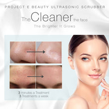 Load image into Gallery viewer, Wireless Ultrasonic Skin Care Scrubber | Exfoliation Spatula Lifting Deep Cleansing Blackhead Dead Skin Wrinkle Remover Pore Cleanser Peeling Anti Aging Skin Rejuvenation Spa Facial Beauty Device
