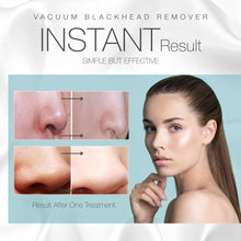 Load image into Gallery viewer, Vacuum+ Blackhead Removal Therapy | Ultrastrong Suction Facial Acne Whitehead Pimple Pore Nose Skin Peeling Shrink Pores Skin Tightening Extractor Cleanser Device USB Rechargeable 5 Treatment Heads
